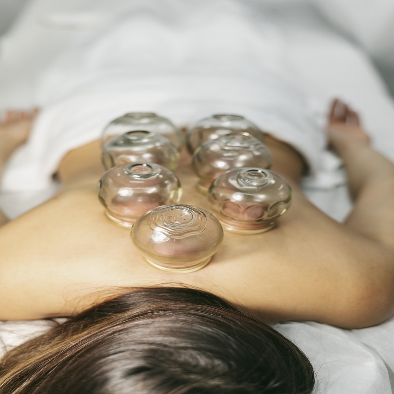 Professional Cupping Therapy for Mind &amp;amp; Body Relief