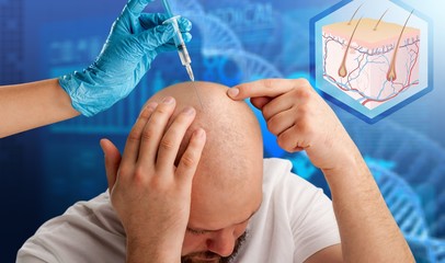 Best Hair Transplant Clinic Manchester - Book Your Free Consultation Today