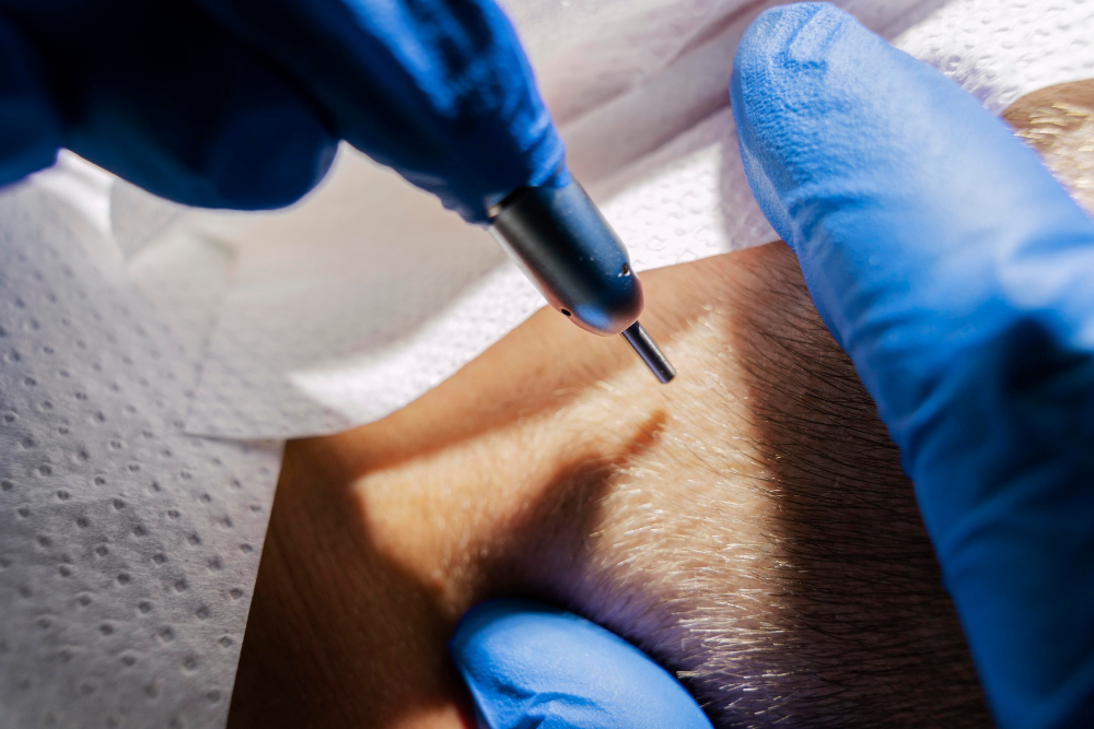 The Best UK Hair Transplant Clinic in London, Leeds &amp; Manchester